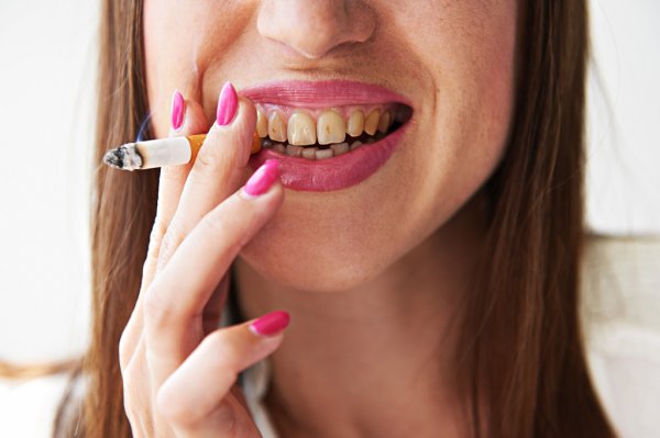 ¿Cómo se relaciona el tabaquismo con la enfermedad de las encías?